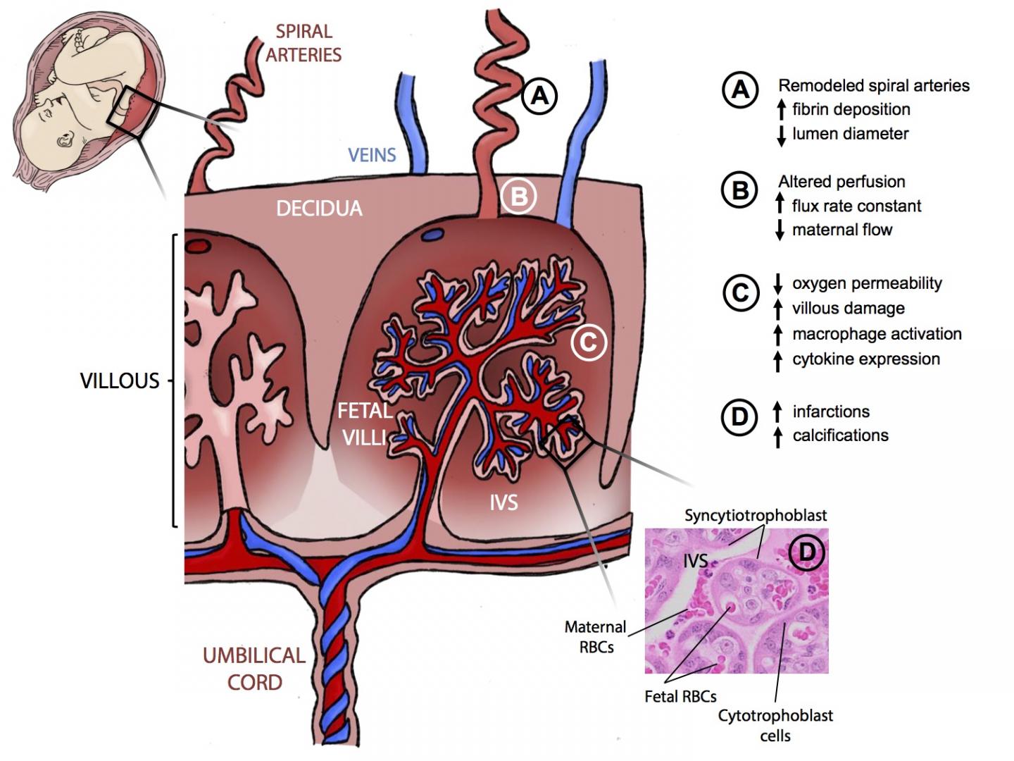 zika placenta