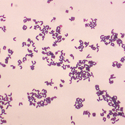 Lapses in Infection Control Responsible for Corynebacterium striatum