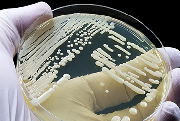 Photo: Infectious Disease Special Edition Candida auris antifungal resistance