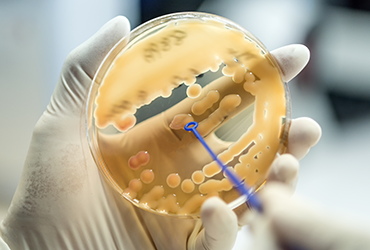 ETEST for Zaynich Tracks Closely With Reference Testing