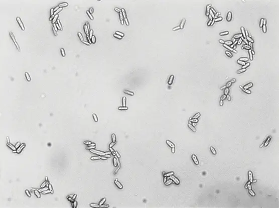 18260406 -Sporothrix-brasiliensis WMC-M-Gomez-Gaviria-etal
