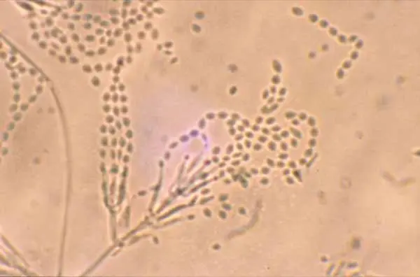 18260406 Paecilomyces-lilacinus
